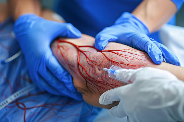 Vascular & Endovascular Hospital in Hyderabad